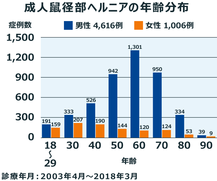 成人鼠径部ヘルニアの年齢分布